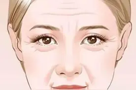 怎样能让皱纹变浅？维持年轻态有办法图片