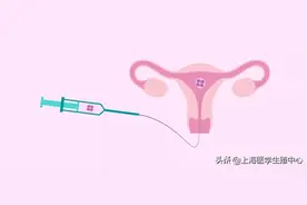 试管婴儿冻胚VS鲜胚！如何移植更有利于怀孕？图片