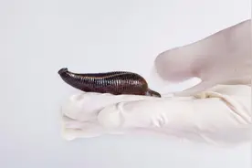 蚂蟥如果不小心被吃进肚子中，它还会在人体内长期存活吗？图片