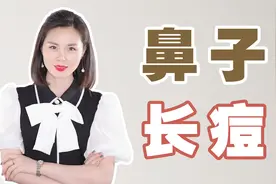 鼻子上长痘怎么办？千万别做这个动作，很多人都中招了视频封面