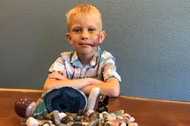 美6岁男孩为救妹妹和狗搏斗缝90针，海瑟薇为他点赞图片