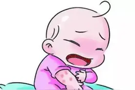 夏季痱子、蚊虫叮咬高发季，宝宝应如何预防？简单几招轻松止痒图片