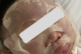 课堂上老师正做实验酒精灯爆炸，被烧伤学生在地上打滚灭火，教育局称4名烧伤学生无生命危险图片