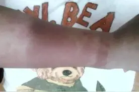 用就烂脸？护肤品里的酒精到底有多可怕？图片