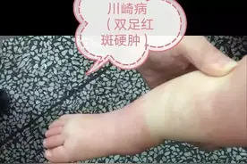 孩子发热五天不见好，家长要当心！一旦延误，终身受损！图片