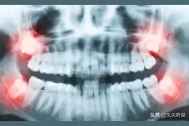 人身体上10个可有可无器官，有些对我们还有害无益图片