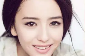 广州牙齿矫正：为什么不拔“虎牙”？图片