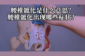 专业医生告诉您：腰椎骶化是怎么回事？视频封面