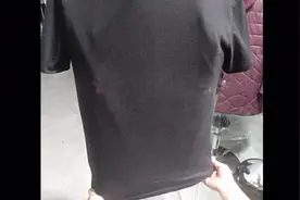 衣服被漂白水烧伤了怎么办？