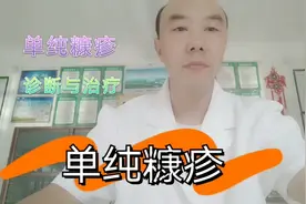 单纯糠疹的诊断与治疗