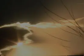 70年代大人物患有眼疾，金针拨障术四五分钟完成，效果令人满意