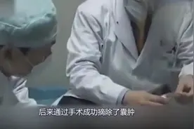 女子怀孕3年，肚子大得快被撑破，打开肚子医生愣了！