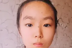 美容医院点痣，这是美人痣吗？视频封面
