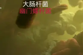 海底捞门店筷子检出大肠菌群#你了解大肠杆菌以及它的危害吗