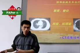 一节课看懂ct成像原理 及如何识别ct影像与相关肺部疾病