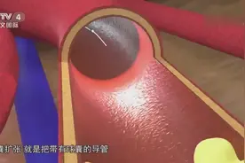 男子切开右脚伤口竟然一滴血也没流，这究竟是怎么回事？一起来看视频封面