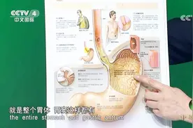幽门螺杆菌多发于我们人体的哪一部位呢？来听听专家的讲解