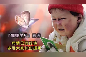 罕见皮肤病女孩圆圆，现病情已有好转，全国各地网友送来祝福