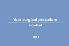 双J管放置动画视频视频封面