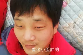 电焊机打眼，眼睑疼痛肿胀，小丁一杯绿茶就消肿。
