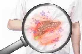 什么是肝脂肪浸润？与脂肪肝的区别是什么？主要是这几点！