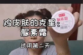 鸡皮肤克星：脲素霜