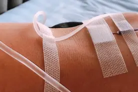 痛风犯了 大早上就去打针 太难了 生活没有一帆风顺