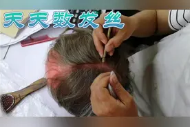 一般认为正常成年人头发总数是8—10万根