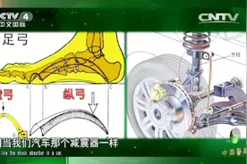 脚底长鸡眼竟与足弓塌陷有关，这到底是怎么回事？听听专家的讲解视频封面