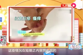 掉色的衣服穿多了会得皮肤癌?衣服掉色还要不要穿,专家这么说