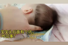 70天的宝宝头后面有个坑，妈妈吓的赶紧带去医院，听听医生怎么说视频封面