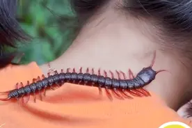 被蜈蚣咬了怎么办？快看这个方法视频封面