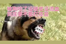 被狗咬了没破皮没出血要不要打疫苗今天总算知道了