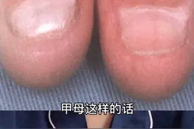 你是否见过这样的指甲？