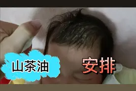 宝宝头上的头皮脂，很多网友说用油，我安排山茶油这样洗视频封面
