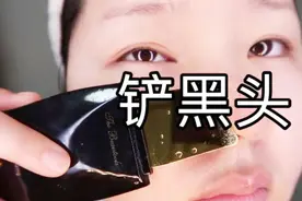 目睹黑头被铲出！黑头铲使用初体验分享~