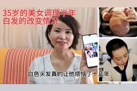 二十年白发用了半年时间来改变，我们来看下她头发变化的一个情况