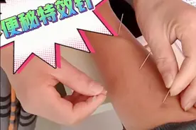 便秘特效针——董氏奇穴三其穴