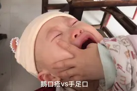 农村娃娃喝奶时不断抠嘴吧，被发现时已经长了一口脓疮，急眼了视频封面