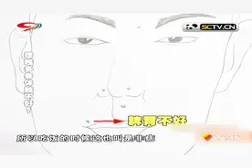 脸上有痣要留意！这些位置有痣会出现大问题，快看看你是否也有呢