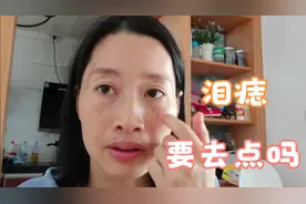听说痣长在眼睛下面命不好，很多网友都建议去点掉，我该相信吗视频封面