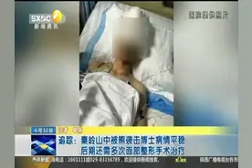 追踪：秦岭山中被熊袭击博士病情平稳 后期还需多次面部整形手术视频封面