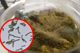 发霉的咸菜，放大1000倍后，霉菌像极了珍珠项链