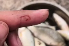 意外发现鲫鱼尾部有这样的线虫，以后钓鱼可要注意了