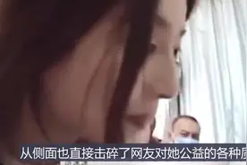 官媒力挺范冰冰做慈善：这种高风险手术公益项目坚持十年实属不易视频封面