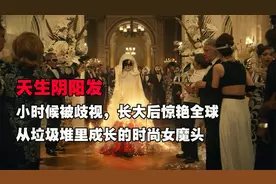 天生阴阳发，小时候被歧视，长大后惊艳全球，视频封面