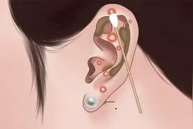 沉浸式清理耳朵|挤痘痘|清理耳垢|解压动画