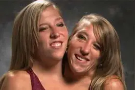 注意这不是P的！是真实存在的双头人姐妹的故事【特殊的身体】