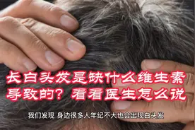 长白头发是缺什么维生素导致的？看看医生怎么说