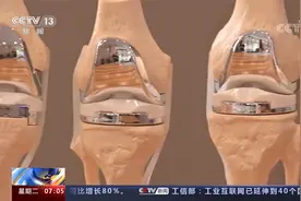 国家组织人工髋关节膝关节集采工作今天开始视频封面